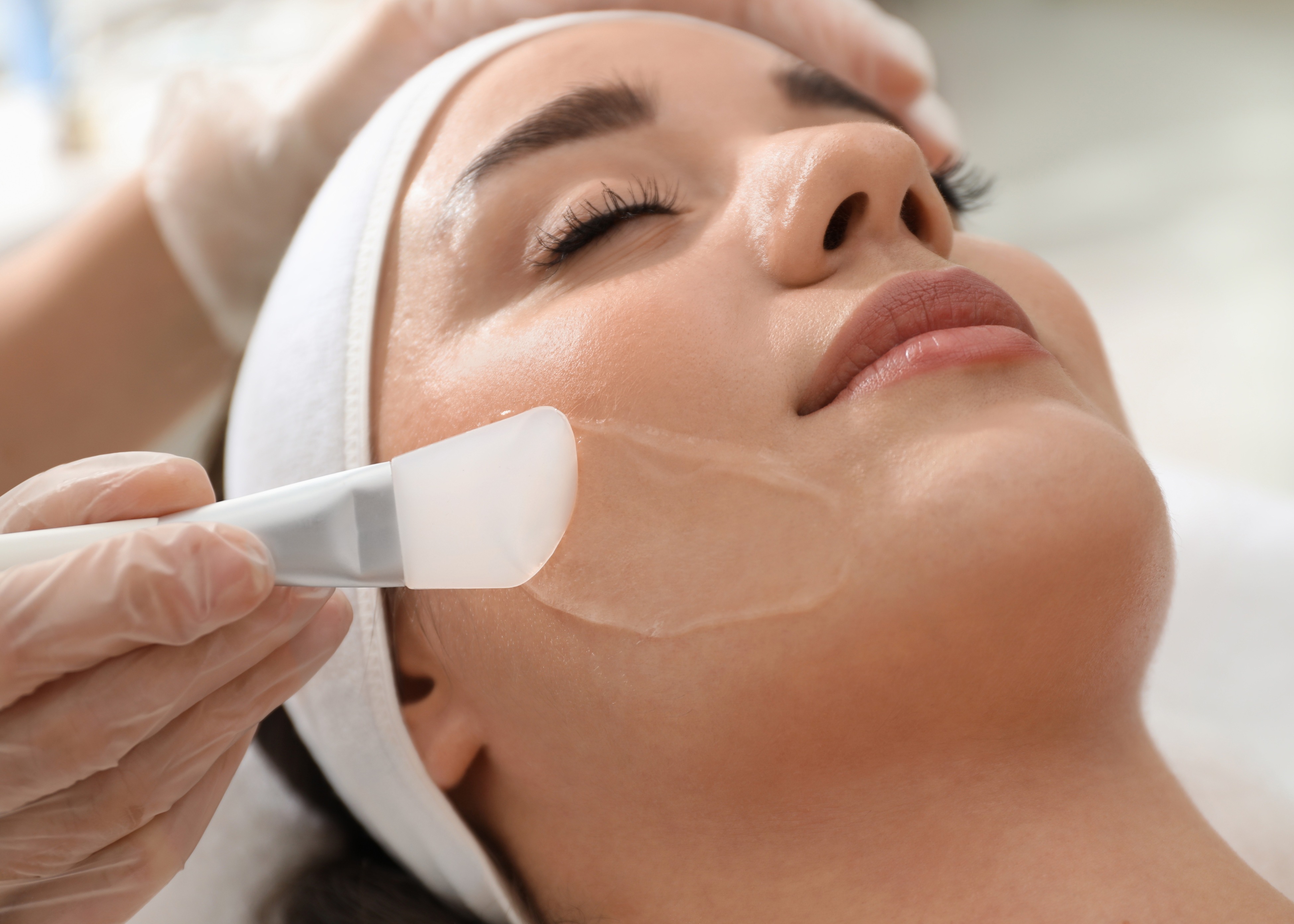 Chemical Peels