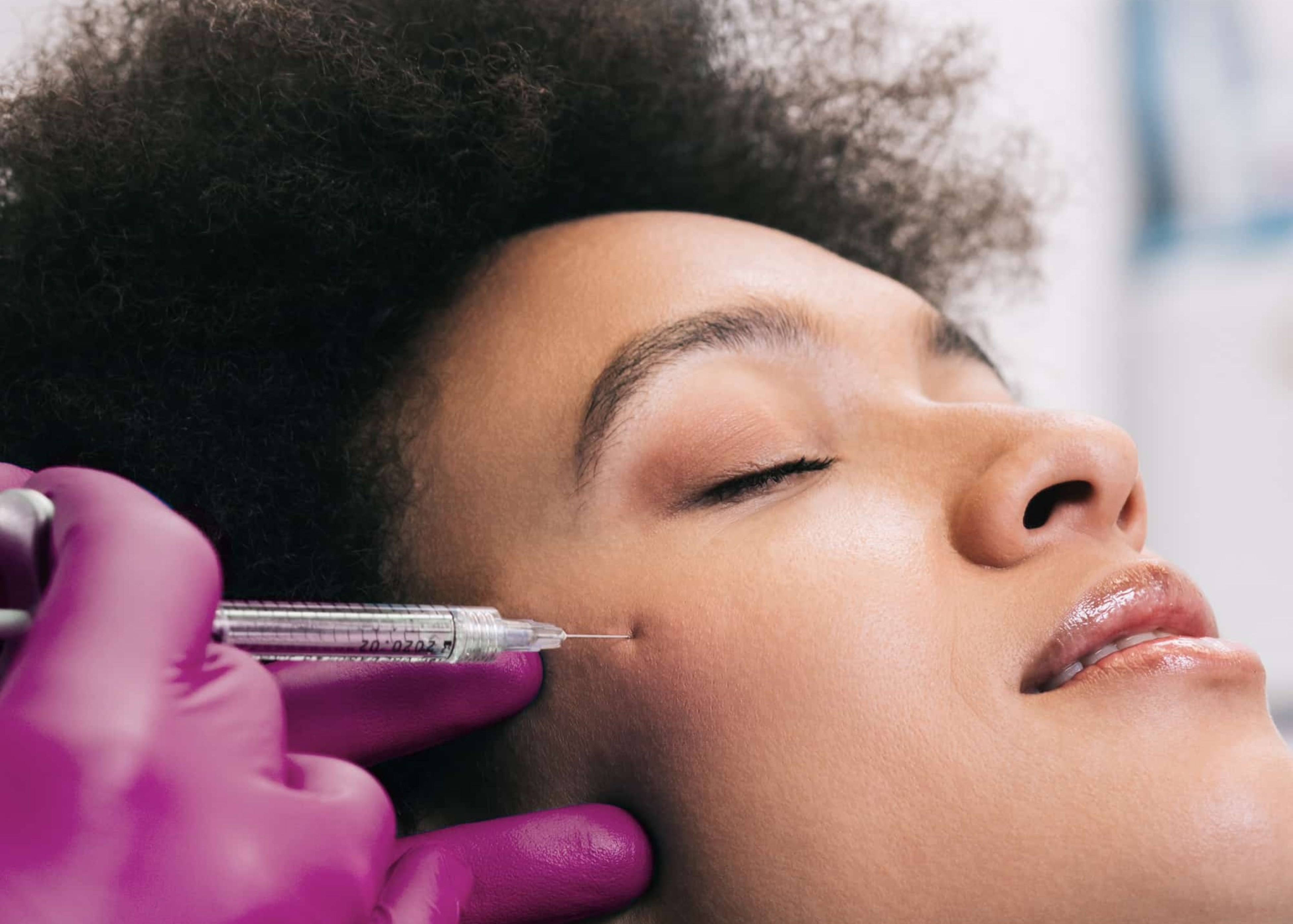 RHA Fillers