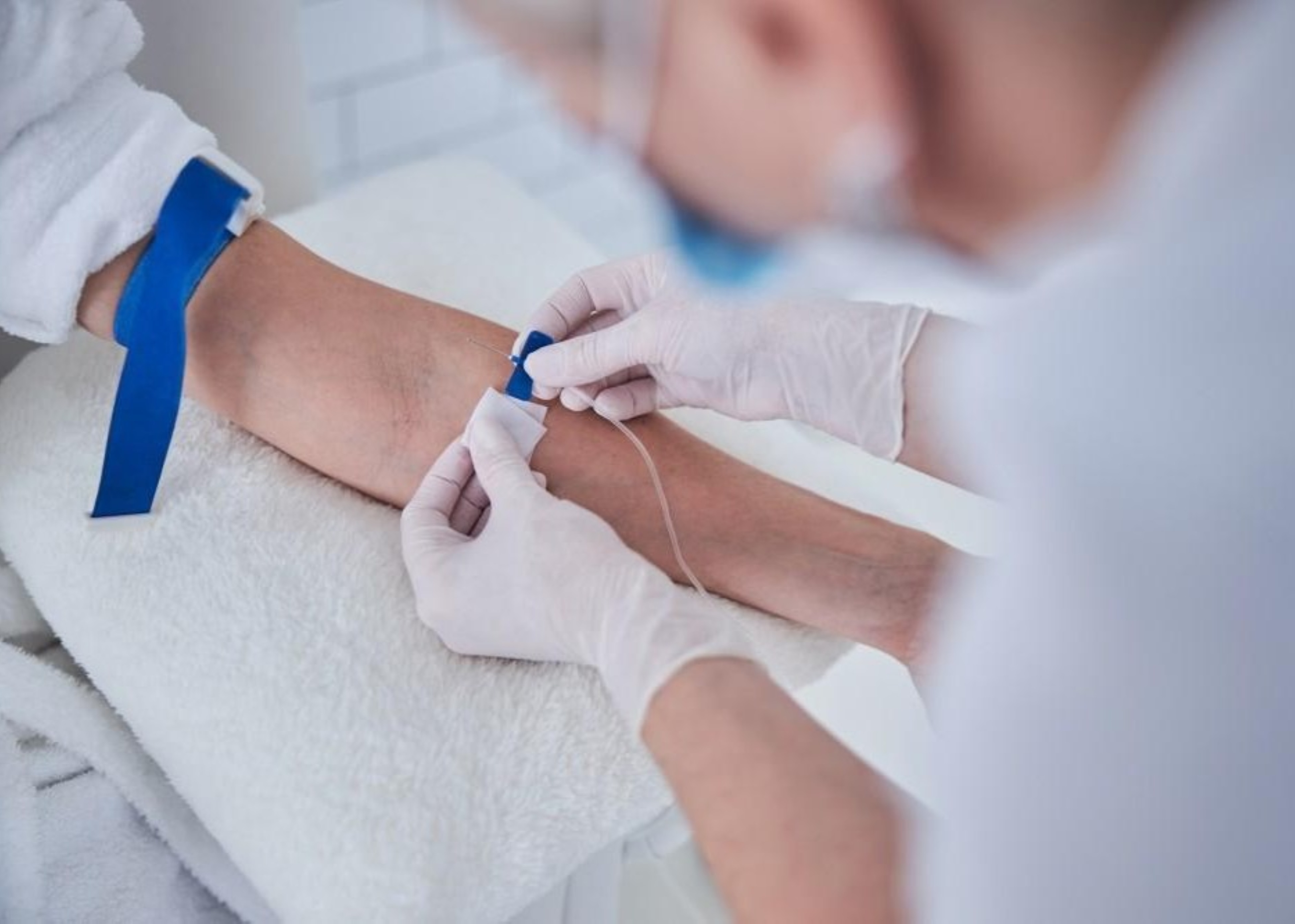 PRP Therapy